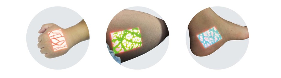 Infrared Vein Finder - conwellmed.com
